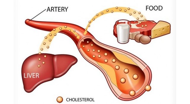 Chẩn Đoán Rối Loạn Chuyển Hóa